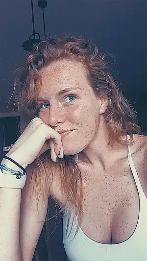 freckles 1 photo